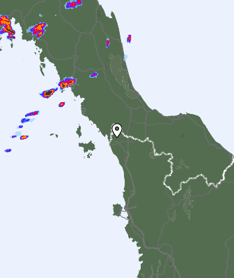 Radar