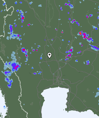 Radar