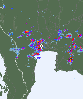 Radar