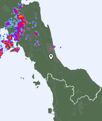 Radar