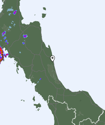 Radar
