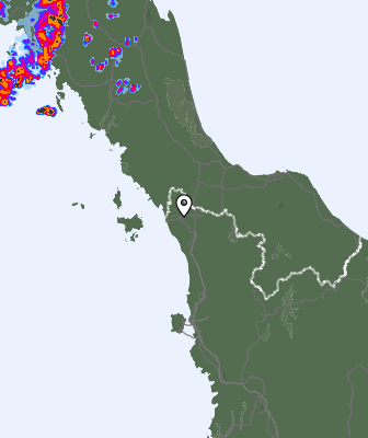 Radar