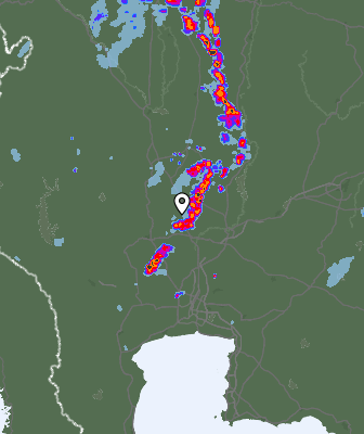 Radar