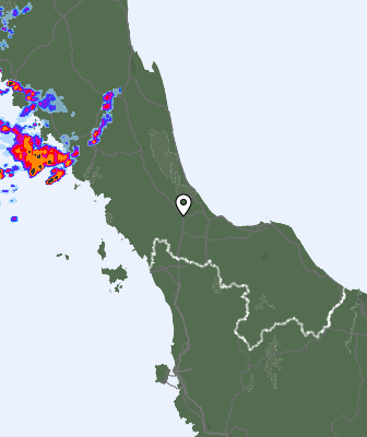Radar
