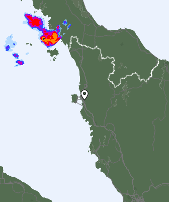Radar
