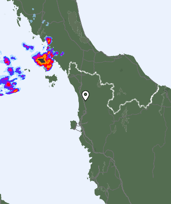 Radar