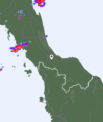 Radar
