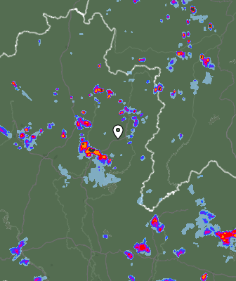 Radar