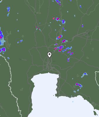 Radar