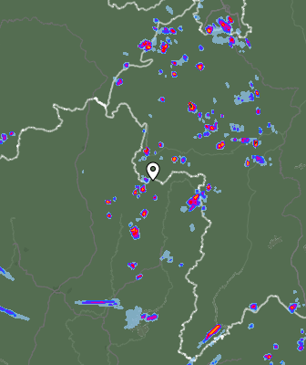 Radar