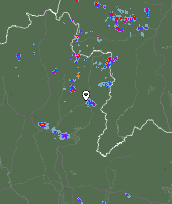 Radar
