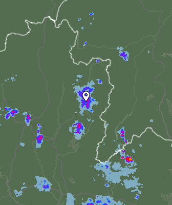Radar