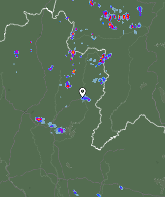 Radar