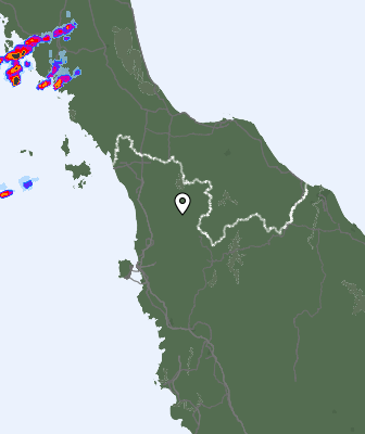 Radar