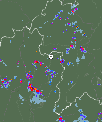 Radar