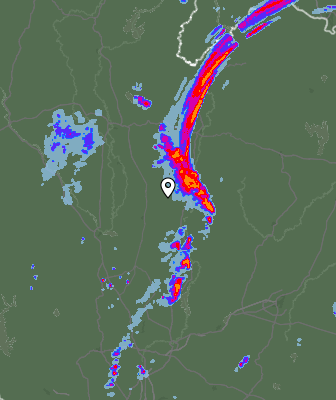 Radar