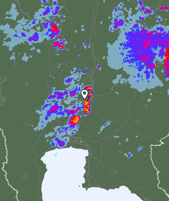 Radar