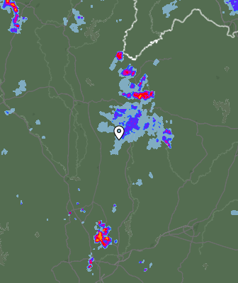 Radar