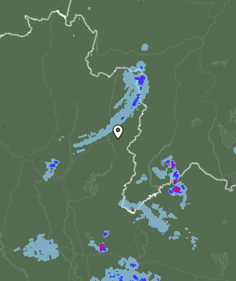 Radar