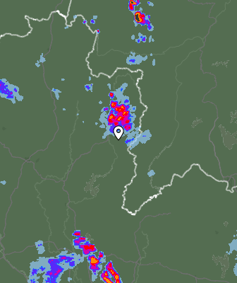 Radar