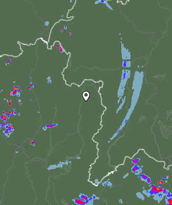 Radar