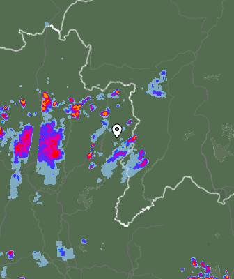 Radar