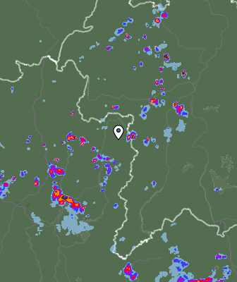 Radar