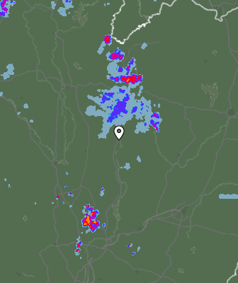 Radar