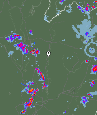 Radar