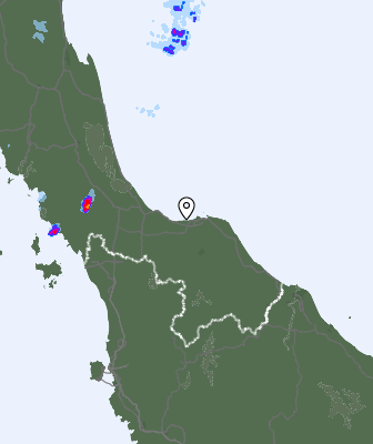 Radar