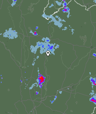 Radar