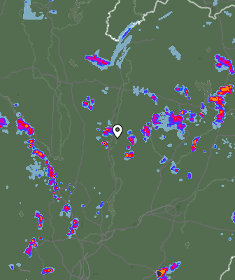 Radar