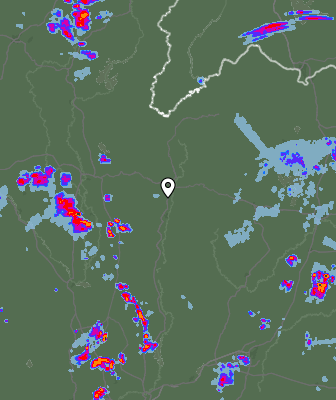 Radar
