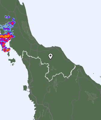Radar
