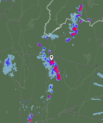 Radar