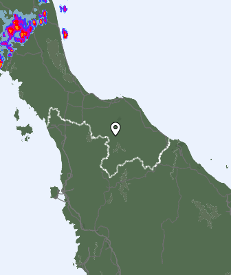 Radar