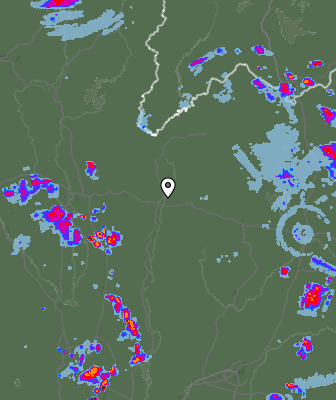 Radar