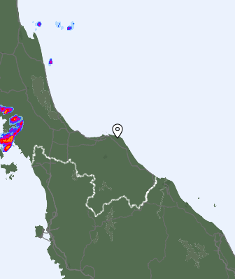 Radar