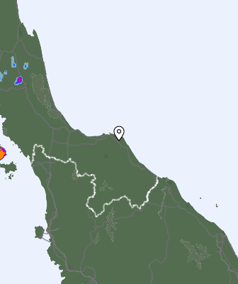 Radar