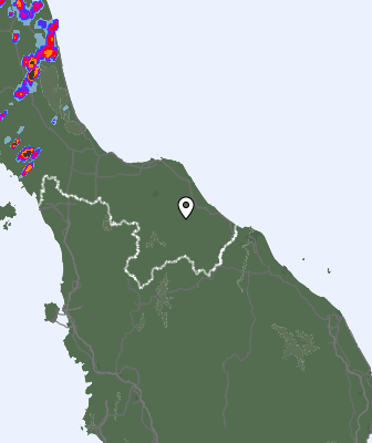 Radar