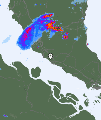 Radar