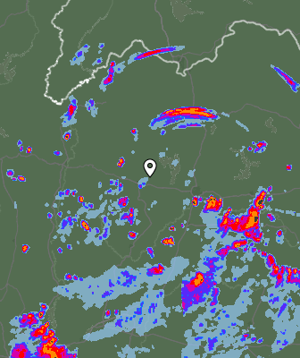 Radar