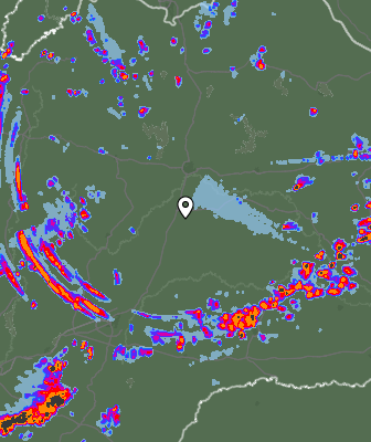Radar