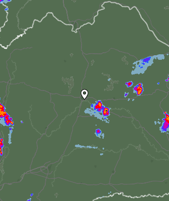Radar