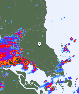 Radar