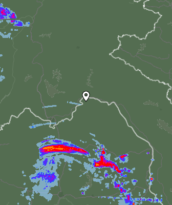 Radar