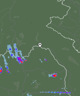 Radar