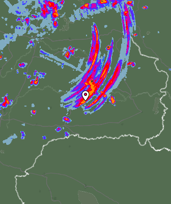 Radar