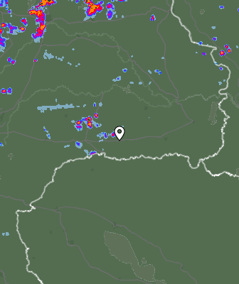Radar