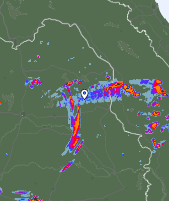 Radar